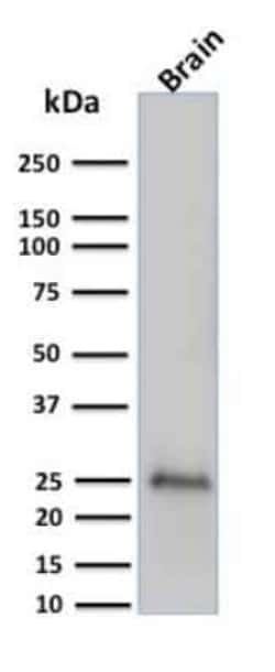 UCH-L1/PGP9.5 Antibody (UCHL1/775), Novus Biologicals 0.02mg; Unlabeled:Antibodies,