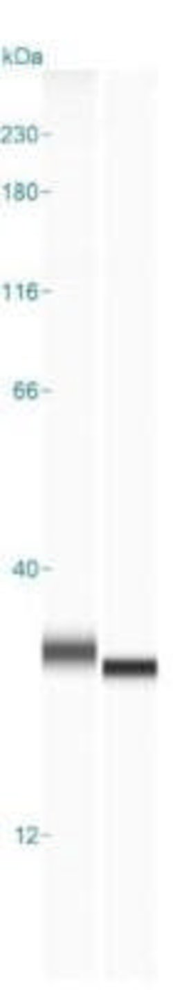 UCH-L1/PGP9.5 Antibody (13C4), Novus Biologicals:Antibodies:Primary Antibodies