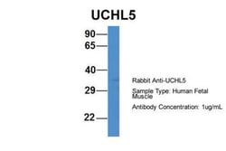 UCH-L5/UCH37 Antibody, Novus Biologicals 100 &mu;L | Buy Online | Novus Biologicals | Fisher Scientific