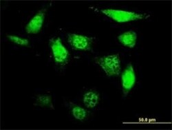 UCKL1 Antibody (8D4), Novus Biologicals 0.1 mg | Buy Online | Novus Biologicals | Fisher Scientific