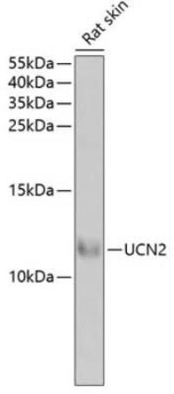 UCN2 Antibody - BSA Free, Novus Biologicals 0.1 mL; Unconjugated:Antibodies,