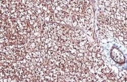 UCP1 Antibody, Novus Biologicals 100 &mu;g | Buy Online | Novus Biologicals | Fisher Scientific