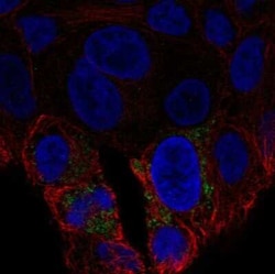 UCP2 Antibody, Novus Biologicals:Antibodies:Primary Antibodies
