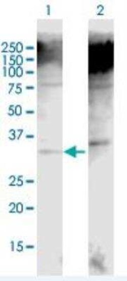 UCP2 Antibody, Novus Biologicals 0.05 mg | Buy Online | Novus Biologicals | Fisher Scientific