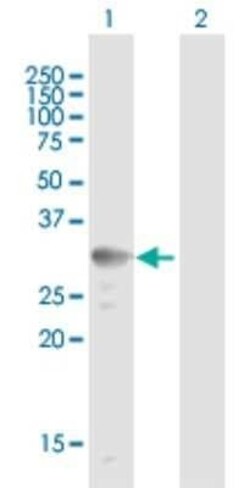 UCP2 Antibody, Novus Biologicals 0.05 mg | Buy Online | Novus Biologicals | Fisher Scientific