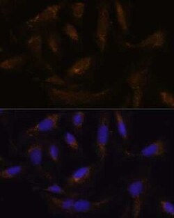 UCP4 Antibody - Azide and BSA Free, Novus Biologicals 0.1 mL; Unconjugated:Antibodies,