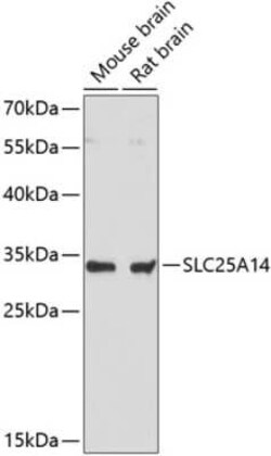 UCP5 Antibody - Azide and BSA Free, Novus Biologicals:Antibodies:Primary