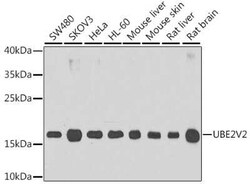 UEV2 Antibody - BSA Free, Novus Biologicals 0.02 mL, Unconjugated:Antibodies,