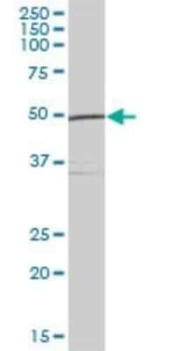 UFM1 Activating Enzyme/UBA5 Antibody, Novus Biologicals 0.05 mg; Unconjugated:Antibodies,