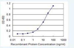 Novus Biologicals UGCG Antibody (1E5), Novus Biologicals 0.1 mg | Buy Online | Novus Biologicals&trade; | Fisher Scientific