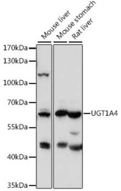 UGT1A4 Antibody - Azide and BSA Free, Novus Biologicals 0.1 mL; Unconjugated:Antibodies,