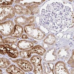 UGT1A6 Antibody, Novus Biologicals 25 &mu;L, Unconjugated:Antibodies, Polyclonal