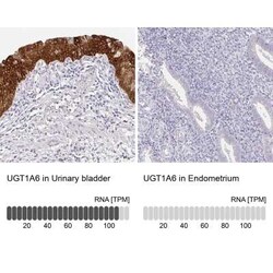 UGT1A6 Antibody, Novus Biologicals 25 &mu;L, Unconjugated:Antibodies, Polyclonal
