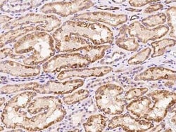 UGT1A6 Antibody, Novus Biologicals 50 &mu;g, Unconjugated:Antibodies, Polyclonal