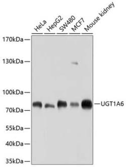 UGT1A6 Antibody - BSA Free, Novus Biologicals:Antibodies:Primary Antibodies