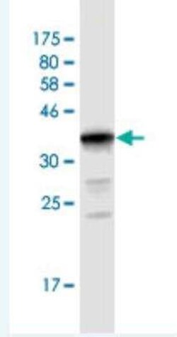 Novus Biologicals UGT2B10 Antibody (1B5), Novus Biologicals 0.1 mg | Buy Online | Novus Biologicals&trade; | Fisher Scientific