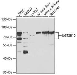 UGT2B10 Antibody - BSA Free, Novus Biologicals 0.02 mL, Unconjugated:Anticuerpos