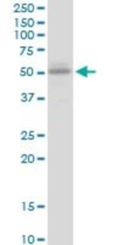 Novus Biologicals UGT2B15 Antibody, Novus Biologicals 0.05 mg | Buy Online | Novus Biologicals&trade; | Fisher Scientific
