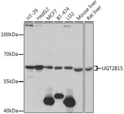 UGT2B15 Antibody - Azide and BSA Free, Novus Biologicals 0.02 mL | Buy Online | Novus Biologicals | Fisher Scientific