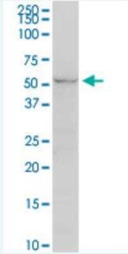 UGT2B7 Antibody (8D12), Novus Biologicals 100 &mu;g;, Unconjugated:Antibodies,