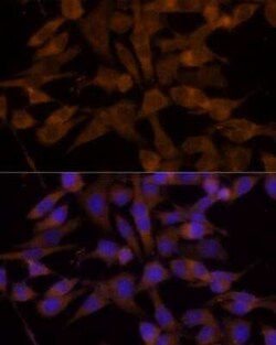UGT2B7 Antibody - Azide and BSA Free, Novus Biologicals 0.02 mL; Unconjugated:Antibodies,