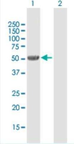UGT2B7 Antibody, Novus Biologicals 50 &mu;g; Unconjugated:Antibodies, Polyclonal