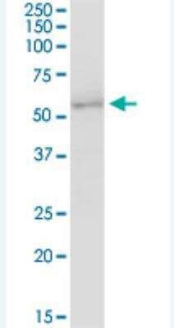 UGT2B7 Antibody, Novus Biologicals 50 &mu;g; Unconjugated:Antibodies, Polyclonal