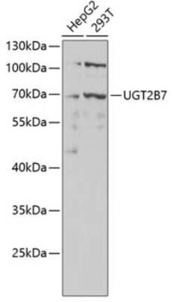 UGT2B7 Antibody - Azide and BSA Free, Novus Biologicals 0.02 mL; Unconjugated:Antibodies,