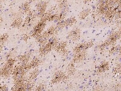 UGT3A1 Antibody, Novus Biologicals:Antibodies:Primary Antibodies