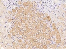 UGT3A1 Antibody, Novus Biologicals:Antibodies:Primary Antibodies