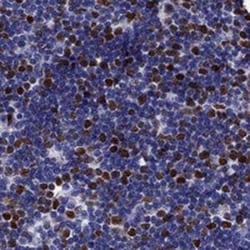 UHRF1 Antibody, Novus Biologicals 25 &mu;L | Buy Online | Novus Biologicals | Fisher Scientific