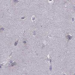UHRF1 Antibody, Novus Biologicals 25 &mu;L | Buy Online | Novus Biologicals | Fisher Scientific