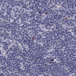 UHRF1 Antibody, Novus Biologicals 25 &mu;L | Buy Online | Novus Biologicals | Fisher Scientific
