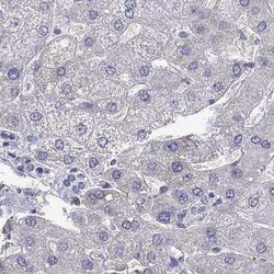 UHRF1 Antibody, Novus Biologicals 25 &mu;L | Buy Online | Novus Biologicals | Fisher Scientific
