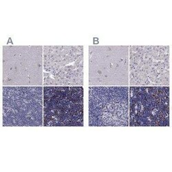 UHRF1 Antibody, Novus Biologicals 25 &mu;L | Buy Online | Novus Biologicals | Fisher Scientific