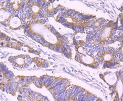 ULK1 Antibody (JA58-36), Novus Biologicals 100&mu;L:Antibodies, Monoclonal