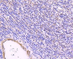 ULK1 Antibody (JA58-36), Novus Biologicals 100&mu;L:Antibodies, Monoclonal