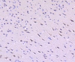 ULK1 Antibody (JA58-36), Novus Biologicals 100&mu;L:Antibodies, Monoclonal