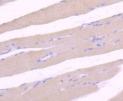 ULK1 Antibody (JA58-36), Novus Biologicals 100&mu;L:Antibodies, Monoclonal