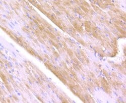 ULK1, Rabbit anti-Human,Mouse,Rat, Polyclonal, Novus Biologicals 100 uL;