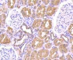 ULK1, Rabbit anti-Human,Mouse,Rat, Polyclonal, Novus Biologicals 100 uL;