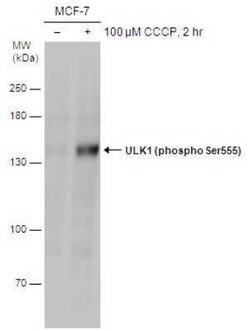ULK1, p Ser555 Antibody, Novus Biologicals 100 μg; Unconjugated:Antibodies,
