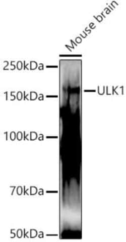 ULK1 Antibody - Azide and BSA Free, Novus Biologicals 0.1 mL; Unconjugated:Antibodies,