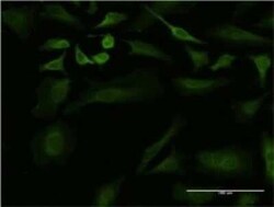 ULK2 Antibody (2A12), Novus Biologicals 0.1 mg | Buy Online | Novus Biologicals | Fisher Scientific