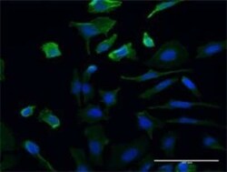 UMPS Antibody (2B10), Novus Biologicals 0.1 mg | Buy Online | Novus Biologicals | Fisher Scientific