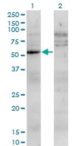 UMPS Antibody (2F5), Novus Biologicals 0.1 mg | Buy Online | Novus Biologicals | Fisher Scientific
