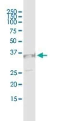 UNC119 Antibody (2F9-2A9), Novus Biologicals 100 &mu;g | Buy Online | Novus Biologicals | Fisher Scientific