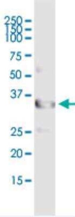 UNC119 Antibody, Novus Biologicals 50 &mu;g | Buy Online | Novus Biologicals | Fisher Scientific