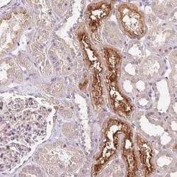 UNC13B Antibody, Novus Biologicals:Antibodies:Primary Antibodies
