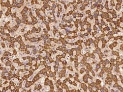 UNC13C Antibody, Novus Biologicals:Antibodies:Primary Antibodies